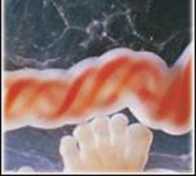 ¿Para qué sirve el cordón umbilical?